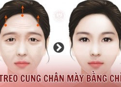 Treo chân mày bằng chỉ: Những ưu - nhược điểm cần lưu ý